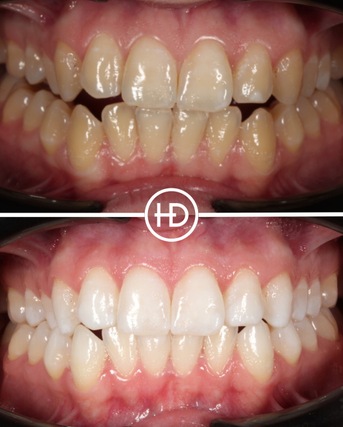 Before and after dental treatment