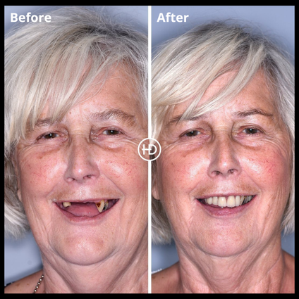 Before and after dental treatment