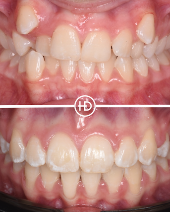 Before and after dental treatment